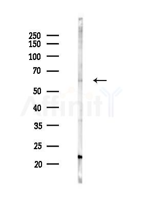 IMPDH1 Antibody - Western blot analysis of lysates from B16F10-LUC cells(UV 30min treatment), using IMPDH1 Antibody at 1/1000 dilution.