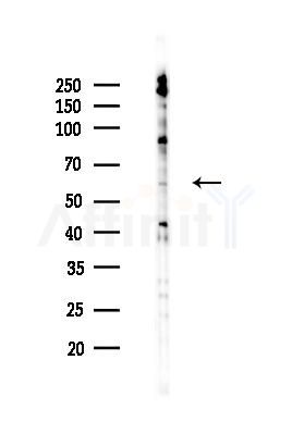 KPNA5 Antibody - Western blot analysis of lysates from 293 cells(UV 30min treatment), using KPNA5 Antibody at 1/1000 dilution.