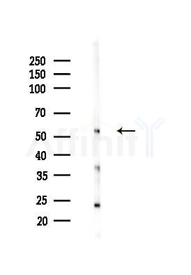 NMD3 Antibody - Western blot analysis of lysates from Mouse lung, using NMD3 Antibody at 1/1000 dilution.
