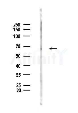 Nurr1/NR4A2 Antibody - Western blot analysis of lysates from Rat brain, using Nurr1/NR4A2 Antibody at 1/1000 dilution.