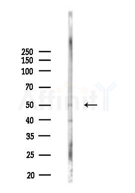 NXN Antibody - Western blot analysis of lysates from Hela cells(LPS 4h treatment), using NXN Antibody at 1/1000 dilution.