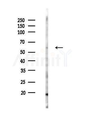 OSBPL2 Antibody - Western blot analysis of lysates from 293 cells(UV 30min treatment), using OSBPL2 Antibody at 1/1000 dilution.