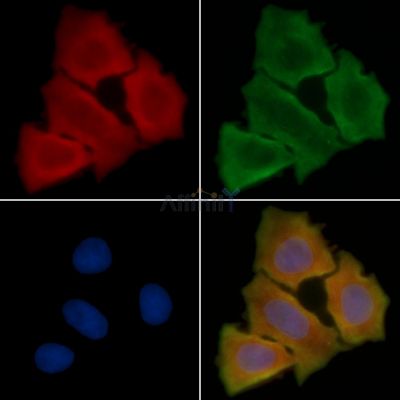 PACSIN2 Antibody - DF12684 staining Hela cells(30min of UV treatment) by IF/ICC.