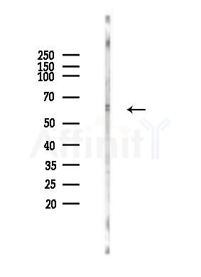 PALMD Antibody - Western blot analysis of lysates from Mouse muscle, using PALMD Antibody at 1/1000 dilution.