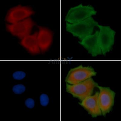 PGAM1 Antibody - DF12693 staining Hela cells(30min of UV treatment) by IF/ICC.