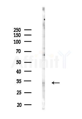 PTGES2 Antibody - Western blot analysis of lysates from Hela cells(LPS 4h treatment), using PTGES2 Antibody at 1/1000 dilution.
