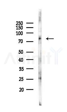 PTPRS Antibody - Western blot analysis of lysates from PC12 cells(starvation 24h treatment), using PTPRS Antibody at 1/1000 dilution.
