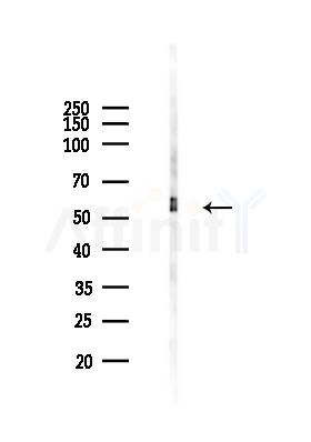SAMM50 Antibody - Western blot analysis of lysates from Rat muscle, using SAMM50 Antibody at 1/1000 dilution.