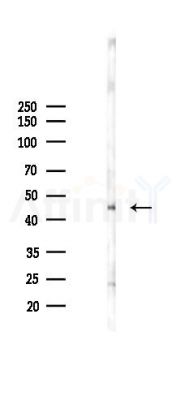 SPTLC1 Antibody - Western blot analysis of lysates from 293 cells(LPS 4h treatment), using SPTLC1 Antibody at 1/1000 dilution.