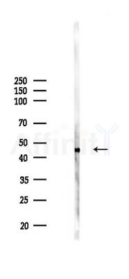 SPTLC1 Antibody - Western blot analysis of lysates from HUVEC cells(LPS 4h treatment), using SPTLC1 Antibody at 1/1000 dilution.
