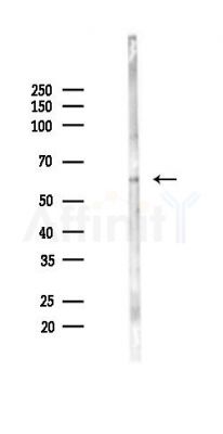 TMEM175 Antibody - Western blot analysis of lysates from Mouse liver, using TMEM175 Antibody at 1/1000 dilution.