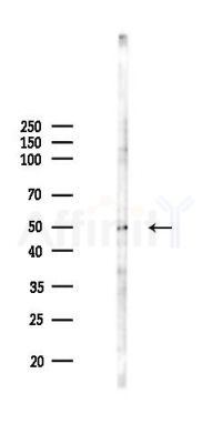 UMPS Antibody - Western blot analysis of lysates from HUVEC cells(LPS 4h treatment), using UMPS Antibody at 1/1000 dilution.