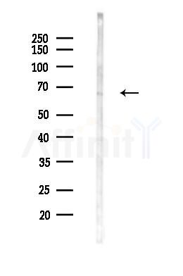 ZNF143 Antibody - Western blot analysis of lysates from B16F10-LUC cells(UV 30min treatment), using ZNF143 Antibody at 1/1000 dilution.