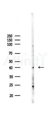 ADIPOR2 Antibody - Western blot analysis of lysates from HUVEC cells(LPS 4h treatment), using ADIPOR2 Antibody at 1/1000 dilution.