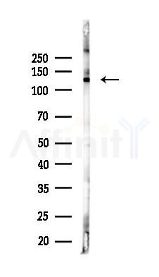 AFAP1L2 Antibody - Western blot analysis of lysates from PC12 cells(starvation 24h treatment), using AFAP1L2 Antibody at 1/1000 dilution.