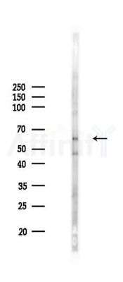 APPBP1 Antibody - Western blot analysis of lysates from HUVEC cells(LPS 4h treatment), using APPBP1 Antibody at 1/1000 dilution.