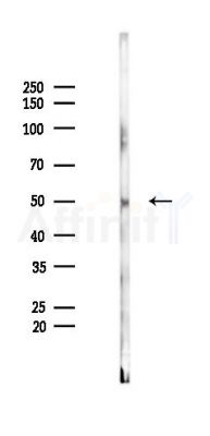 B3GNT3 Antibody - Western blot analysis of lysates from Rat testis, using B3GNT3 Antibody at 1/1000 dilution.