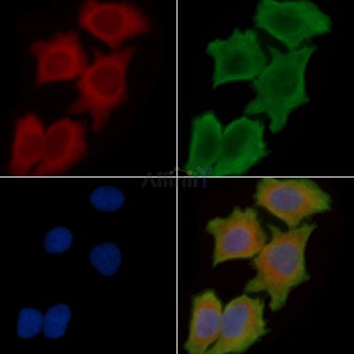 BCAT2 Antibody - DF12851 staining Hela cells(30min of UV treatment) by IF/ICC.