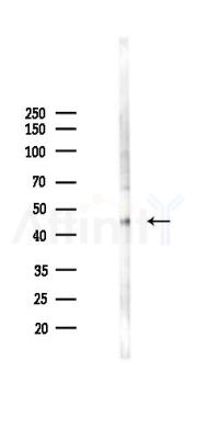 BLMH Antibody - Western blot analysis of lysates from 293 cells(LPS 4h treatment), using BLMH Antibody at 1/1000 dilution.