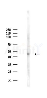 BLMH Antibody - Western blot analysis of lysates from HUVEC cells(LPS 4h treatment), using BLMH Antibody at 1/1000 dilution.