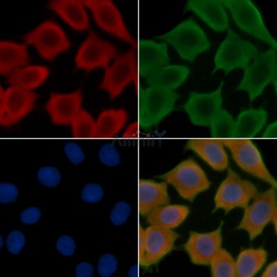 Connexin-46 Antibody - DF12907 staining Hela cells(30min of UV treatment) by IF/ICC.