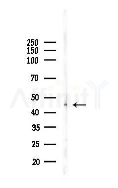 DOC2B Antibody - Western blot analysis of lysates from Rat kidney, using DOC2B Antibody at 1/1000 dilution.
