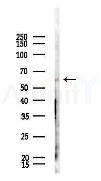 ENPP4 Antibody - Western blot analysis of lysates from PC12 cells(UV 30min treatment), using ENPP4 Antibody at 1/1000 dilution.