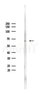 EYA3 Antibody - Western blot analysis of lysates from 293 cells(LPS 4h treatment), using EYA3 Antibody at 1/1000 dilution.
