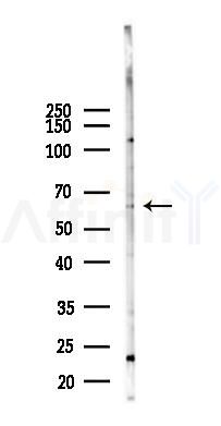 FAM13A Antibody - Western blot analysis of lysates from Hela cells(LPS 4h treatment), using FAM13A Antibody at 1/1000 dilution.