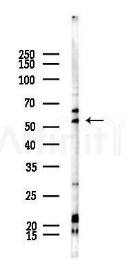 FBXW2 Antibody - Western blot analysis of lysates from PC12 cells(UV 30min treatment), using FBXW2 Antibody at 1/1000 dilution.
