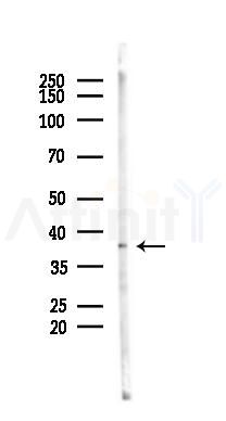 FOXR2 Antibody - Western blot analysis of lysates from Mouse brain, using FOXR2 Antibody at 1/1000 dilution.