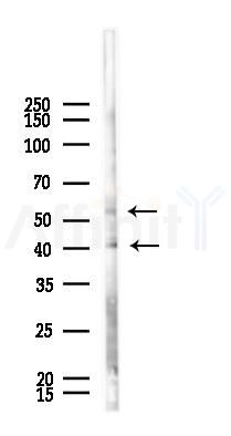GABPB1 Antibody - Western blot analysis of lysates from PC12 cells(UV 30min treatment), using GABPB1 Antibody at 1/1000 dilution.