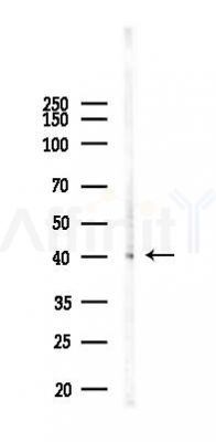 GABPB1 Antibody - Western blot analysis of lysates from Hela cells(LPS 4h treatment), using GABPB1 Antibody at 1/1000 dilution.