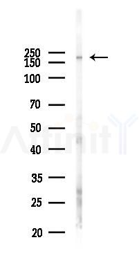 GBF1 Antibody - Western blot analysis of lysates from Hela cells(LPS 4h treatment), using GBF1 Antibody at 1/1000 dilution.