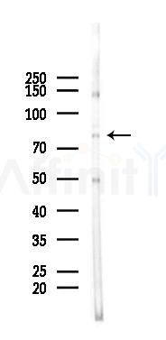 INTS9 Antibody - Western blot analysis of lysates from 293 cells(LPS 4h treatment), using INTS9 Antibody at 1/1000 dilution.