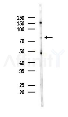 INTS9 Antibody - Western blot analysis of lysates from Hela cells(heat-shock 45min treatment), using INTS9 Antibody at 1/1000 dilution.
