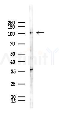 KANK2 Antibody - Western blot analysis of lysates from PC12 cells(UV 30min treatment), using KANK2 Antibody at 1/1000 dilution.