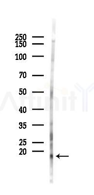 LC3C Antibody - Western blot analysis of lysates from 293 cells(LPS 4h treatment), using LC3C Antibody at 1/1000 dilution.