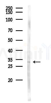 LETM2 Antibody - Western blot analysis of lysates from 293 cells(LPS 4h treatment), using LETM2 Antibody at 1/1000 dilution.