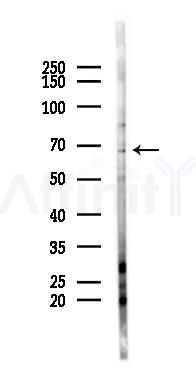 MEX3C Antibody - Western blot analysis of lysates from 293 cells(LPS 4h treatment), using MEX3C Antibody at 1/1000 dilution.