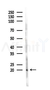 MFAP5 Antibody - Western blot analysis of lysates from Hela cells(heat-shock 45min treatment), using MFAP5 Antibody at 1/1000 dilution.