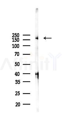 C3 Antibody - Western blot analysis of lysates from Rat lung, using C3 Antibody at 1/1000 dilution.