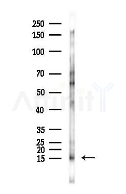 PBR Antibody - Western blot analysis of lysates from Mouse brain, using PBR Antibody at 1/1000 dilution.