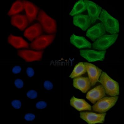 TRP1 Antibody - DF13325 staining Hela cells(30min of UV treatment) by IF/ICC.