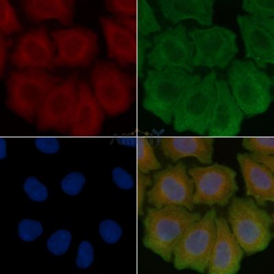 ITPR2 Antibody - DF13336 staining Hela cells(30min of UV treatment) by IF/ICC.