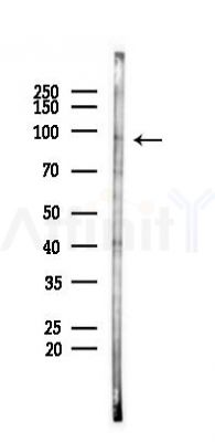 ZW10 Antibody - Western blot analysis of lysates from 293 cells(starvation 24h treatment), using ZW10 Antibody at 1/1000 dilution.