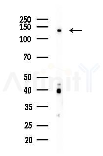 Exportin-5 Antibody - Western blot analysis of lysates from COLO205 cells(heat-shock 45min treatment), using Exportin-5 Antibody at 1/1000 dilution.