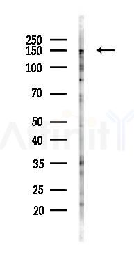 SCC112 Antibody - Western blot analysis of lysates from COLO205 cells(heat-shock 45min treatment), using SCC112 Antibody at 1/1000 dilution.