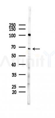 Lysyl tRNA synthetase Antibody - Western blot analysis of lysates from HUVEC cells(starvation 24h treatment), using Lysyl tRNA synthetase Antibody at 1/1000 dilution.