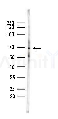 Lysyl tRNA synthetase Antibody - Western blot analysis of lysates from Rat heart, using Lysyl tRNA synthetase Antibody at 1/1000 dilution.